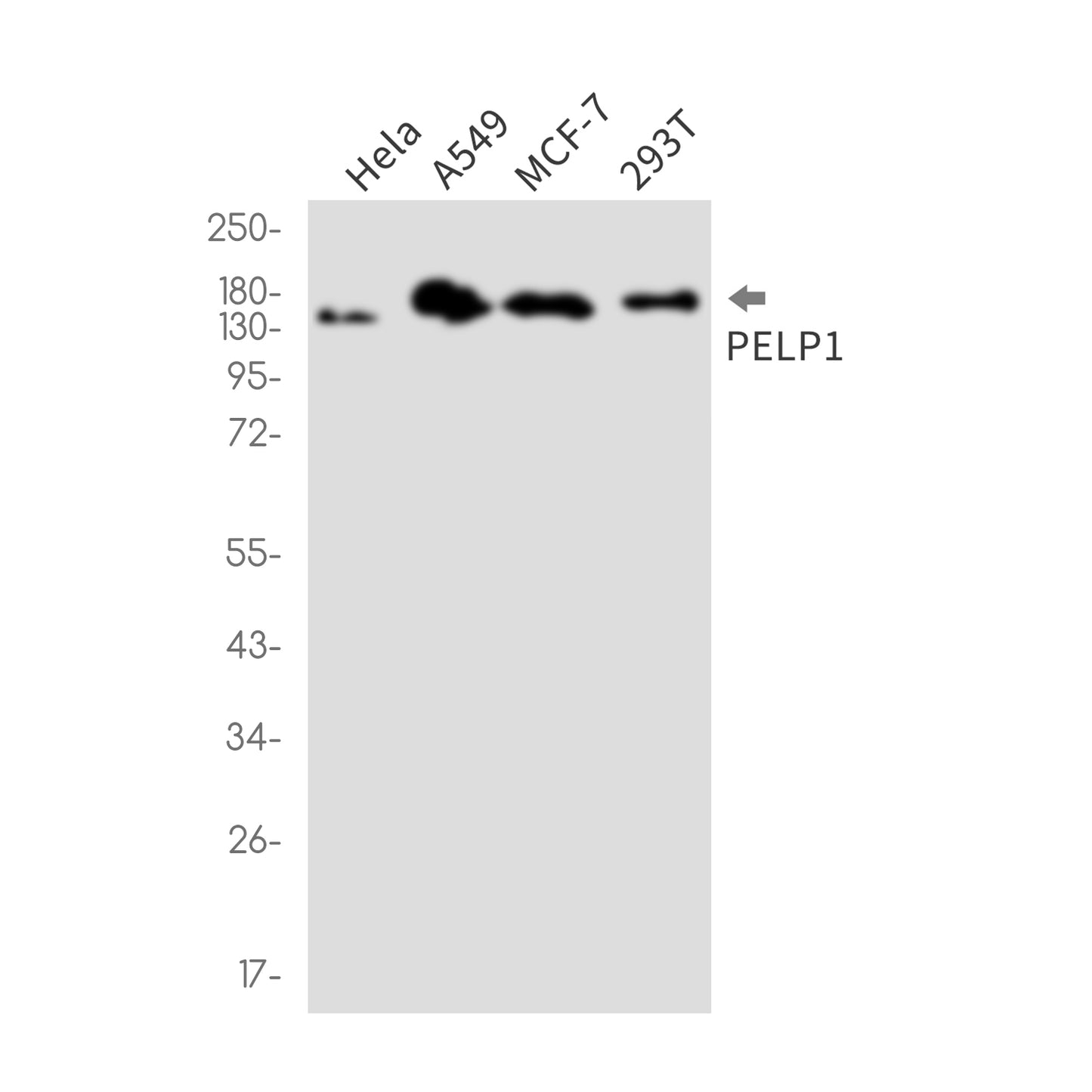 PELP1 (18D12) Rabbit Monoclonal Antibody