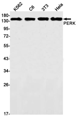 PERK (16C18) Rabbit Monoclonal Antibody
