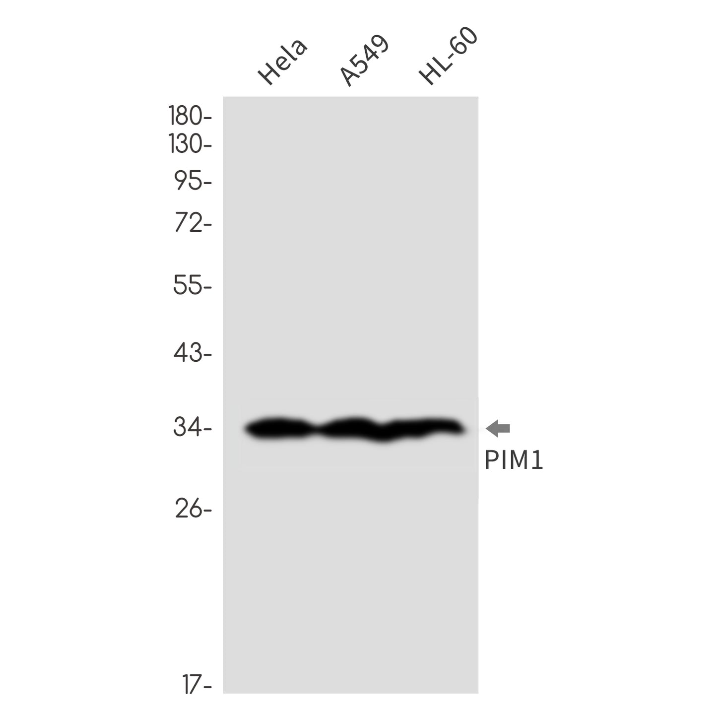 PIM1  (3I7) Rabbit Monoclonal Antibody