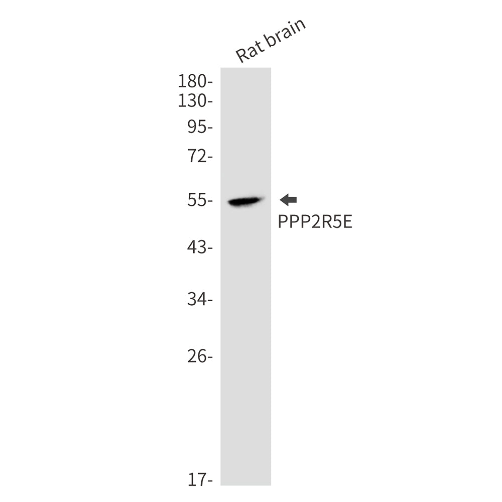 PPP2R5E (10K3) Rabbit Monoclonal Antibody