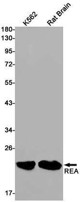 RAC3 (9M14) Rabbit Monoclonal Antibody