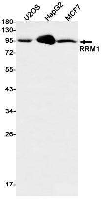 RRM1 (14K2) Rabbit Monoclonal Antibody
