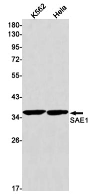 SAE1 (17L1) Rabbit Monoclonal Antibody