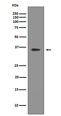 SIRT2  (7W12) Rabbit Monoclonal Antibody