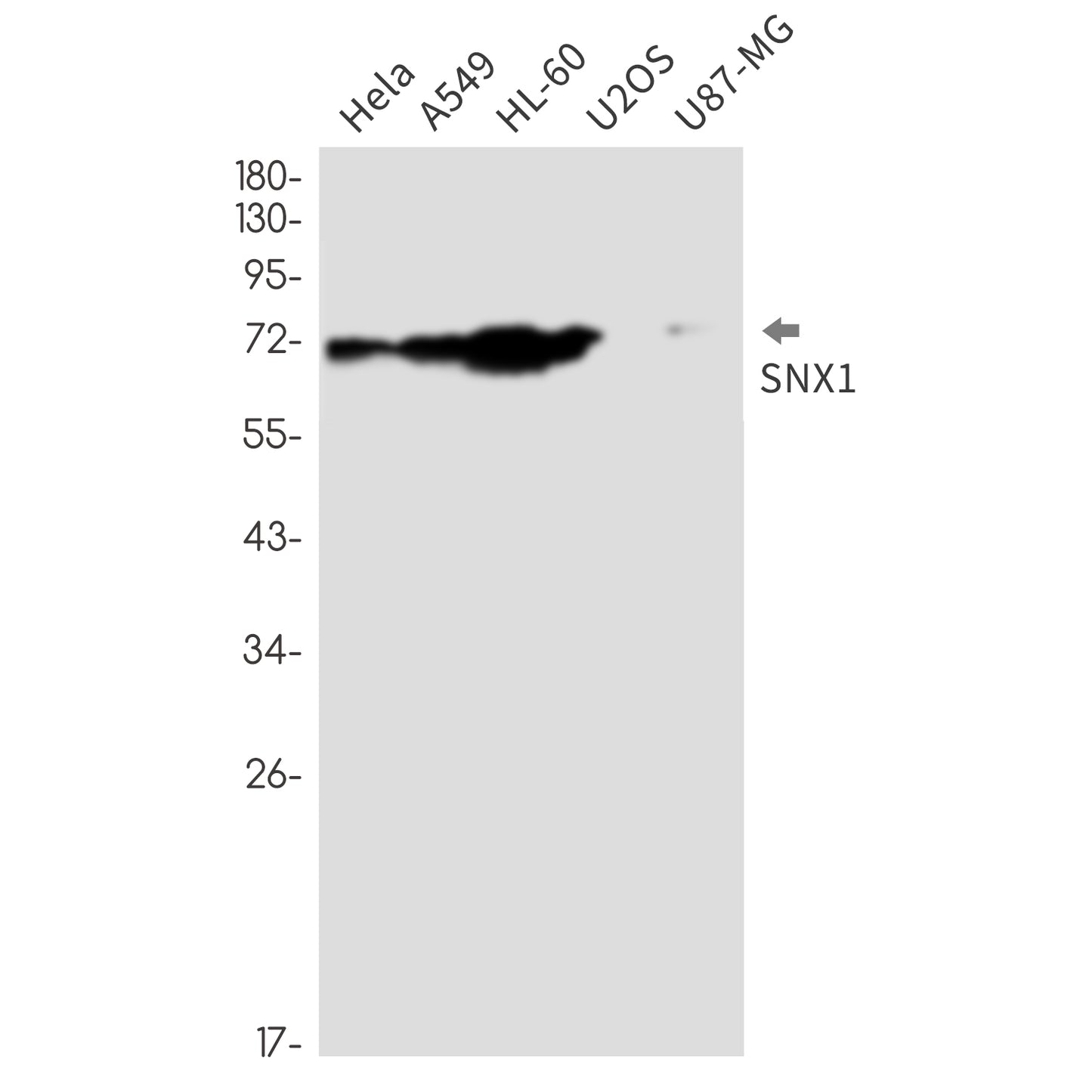 SNX1 (3I2) Rabbit Monoclonal Antibody