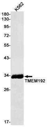 TMEM192 (10L14) Rabbit Monoclonal Antibody