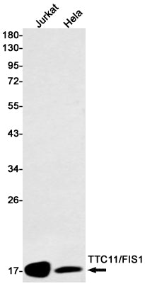 TTC11 (18H3) Rabbit Monoclonal Antibody