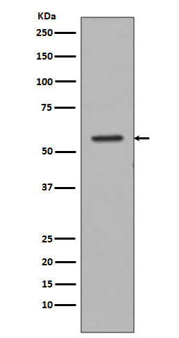 Tyrosine Hydroxylase  (15J18) Rabbit Monoclonal Antibody