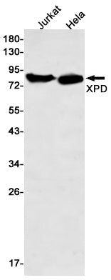 XPD (19K14) Rabbit Monoclonal Antibody