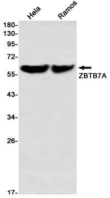 ZBTB7A (12S1) Rabbit Monoclonal Antibody