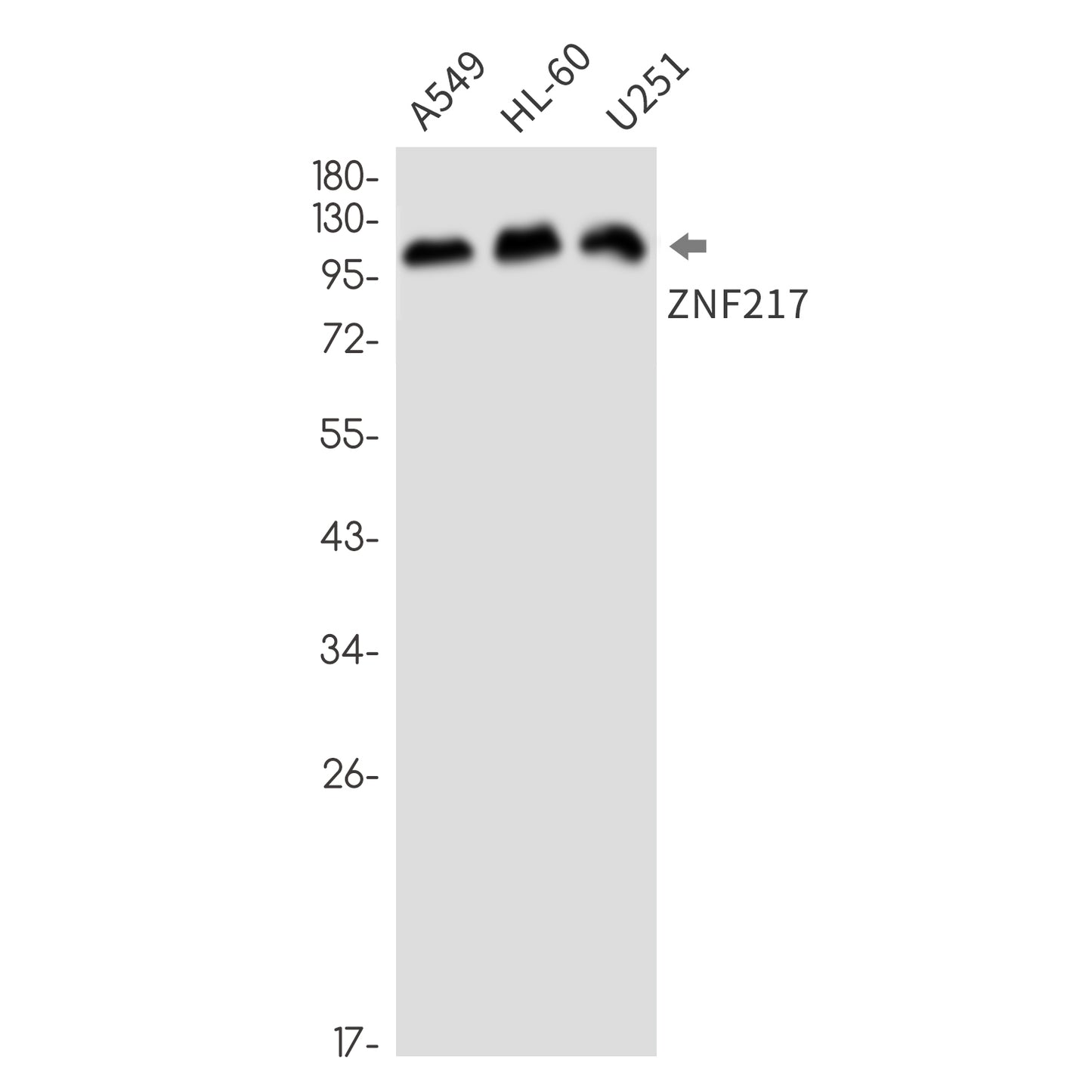 ZNF217 (18Y16) Rabbit Monoclonal Antibody