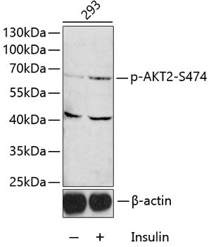 Phospho-AKT2-S474 Rabbit pAb