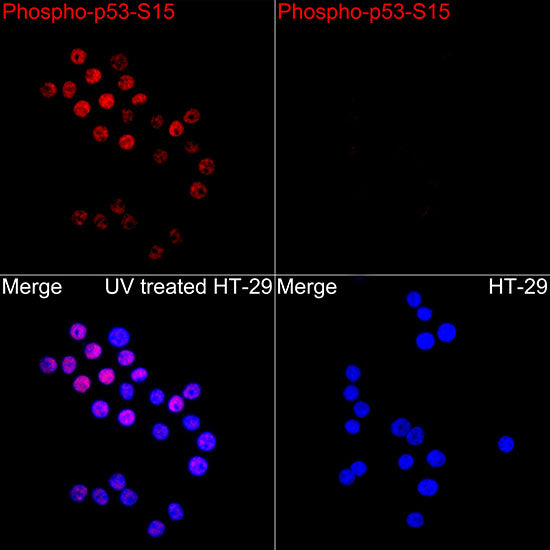 Phospho-p53-S15 Rabbit pAb