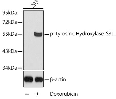 Phospho-Tyrosine Hydroxylase-S31 Rabbit pAb