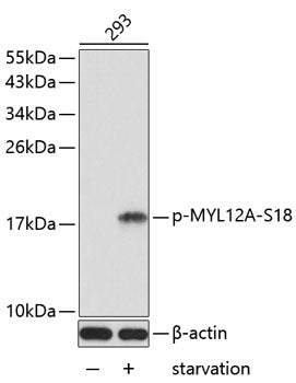 Phospho-MYL12A-S18 Rabbit pAb
