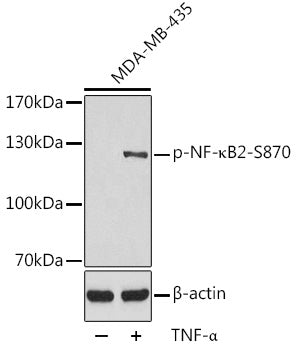 Phospho-NF-κB2-S870 Rabbit pAb
