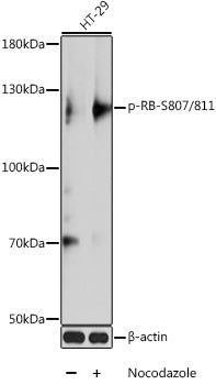 Phospho-RB-S807/811 Rabbit pAb