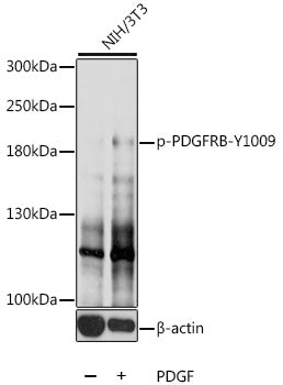 Phospho-PDGFRB-Y1009 Rabbit pAb