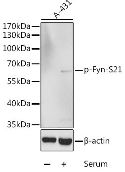 Phospho-Fyn-S21 Rabbit pAb