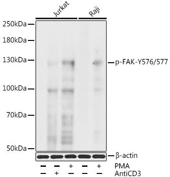 Phospho-FAK-Y576/577 Rabbit pAb