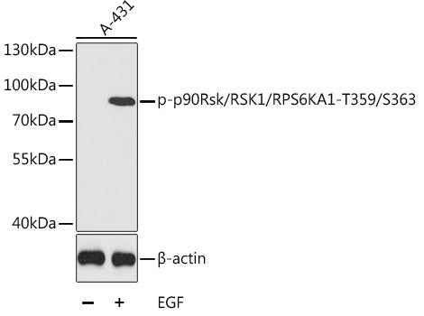 Phospho-p90Rsk/RSK1/RPS6KA1-T359/S363 Rabbit pAb