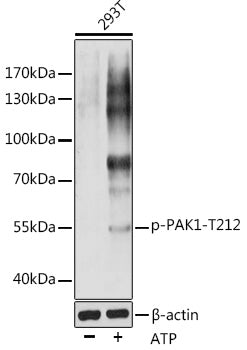 Phospho-PAK1-T212 Rabbit pAb