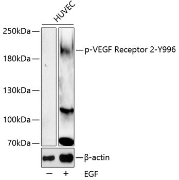 Phospho-VEGF Receptor 2-Y996 Rabbit pAb