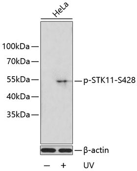 Phospho-STK11-S428 Rabbit pAb