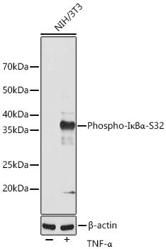 Phospho-IκBα-S32 Rabbit mAb
