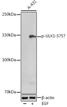 Phospho-ULK1-S757 Rabbit pAb