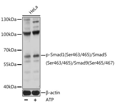 Phospho-Smad1-S463/465 + Smad5-S463/465 + Smad9-S465/467 Rabbit pAb