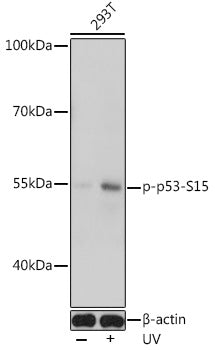 Phospho-p53-S15 Rabbit pAb