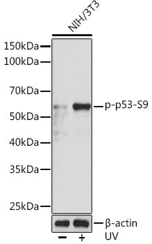 Phospho-p53-S9 Rabbit mAb