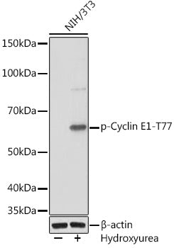 Phospho-Cyclin E1-T77 Rabbit mAb
