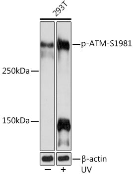 Phospho-ATM-S1981 Rabbit mAb