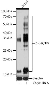 pan Phospho-Serine/Threonine Mouse mAb