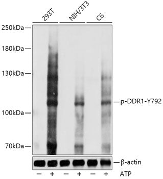 Phospho-DDR1-Y792 Rabbit pAb