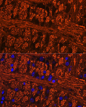 Phospho-Tau-Ser404 Rabbit pAb