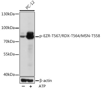 Phospho-EZR-T567/RDX-T564/MSN-T558 Rabbit pAb