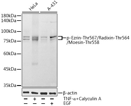Phospho-Ezrin-Thr567/Radixin-Thr564/Moesin-Thr558 Rabbit pAb