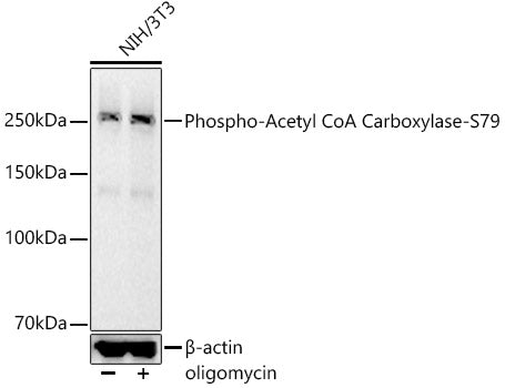 Phospho-Acetyl CoA Carboxylase-S79 Rabbit mAb