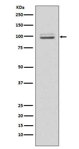 MKLP1 Rabbit Polyclonal Antibody