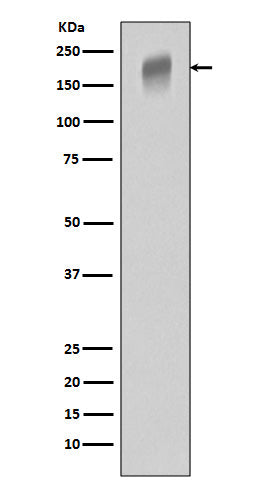 VEGF Receptor 1 Rabbit Polyclonal Antibody