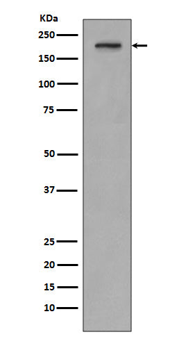 PDGFR beta Rabbit Polyclonal Antibody