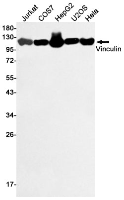Vinculin Rabbit Polyclonal Antibody