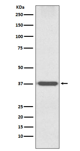 OTX1 Rabbit Polyclonal Antibody
