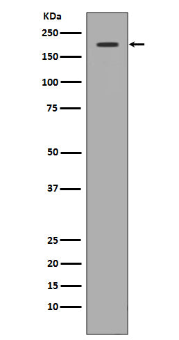 c-Met Rabbit Polyclonal Antibody