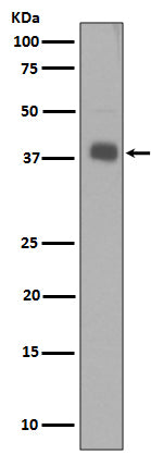 Synaptophysin Rabbit Polyclonal Antibody