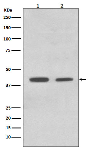 ACADM Rabbit Polyclonal Antibody