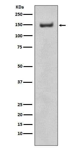 ROCK1 Rabbit Polyclonal Antibody
